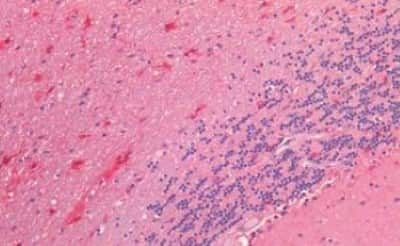 Immunohistochemistry-Paraffin: Neuritin Antibody [NBP3-14418]